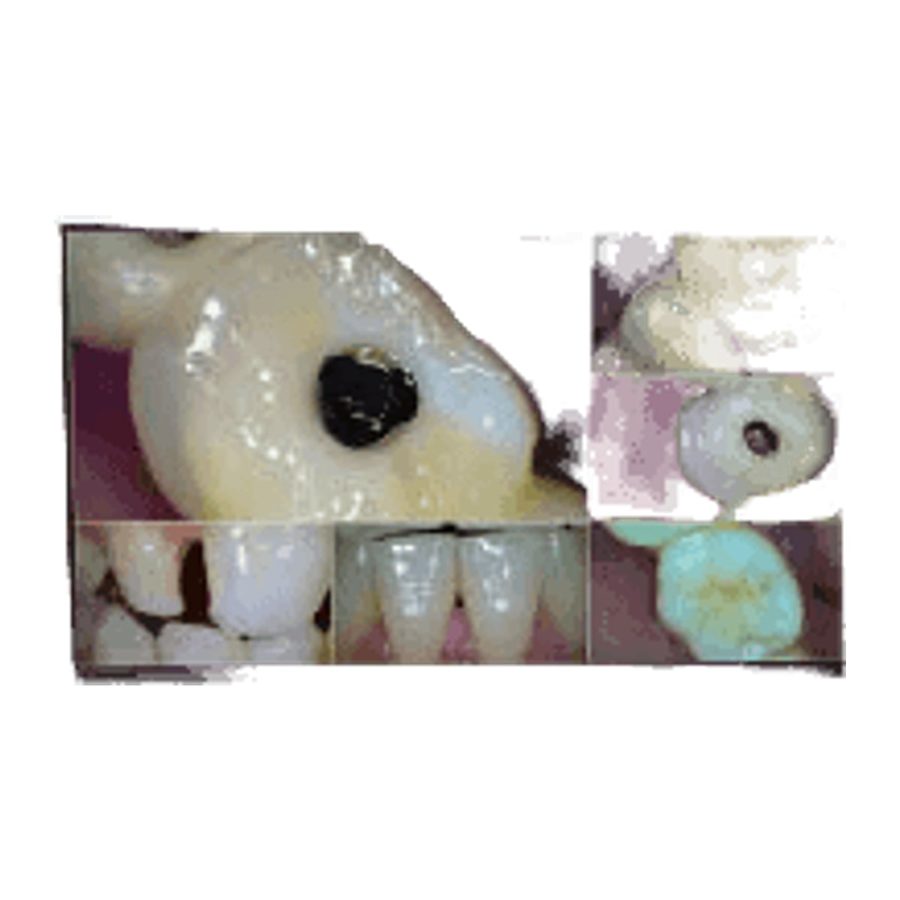 Intraoral Camera DL-CF988