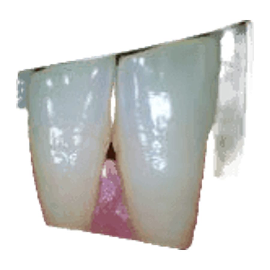 Intraoral Camera DL-M-988A